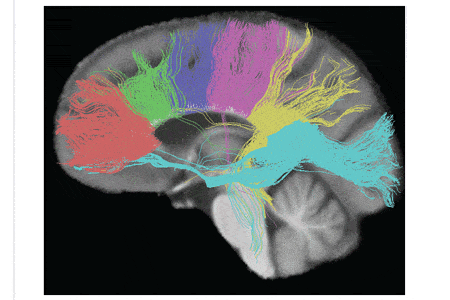 One Brain or Two Hemispheres